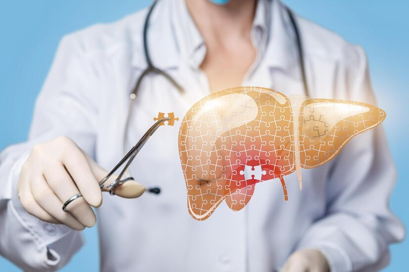 Hepatobiliary Diseases